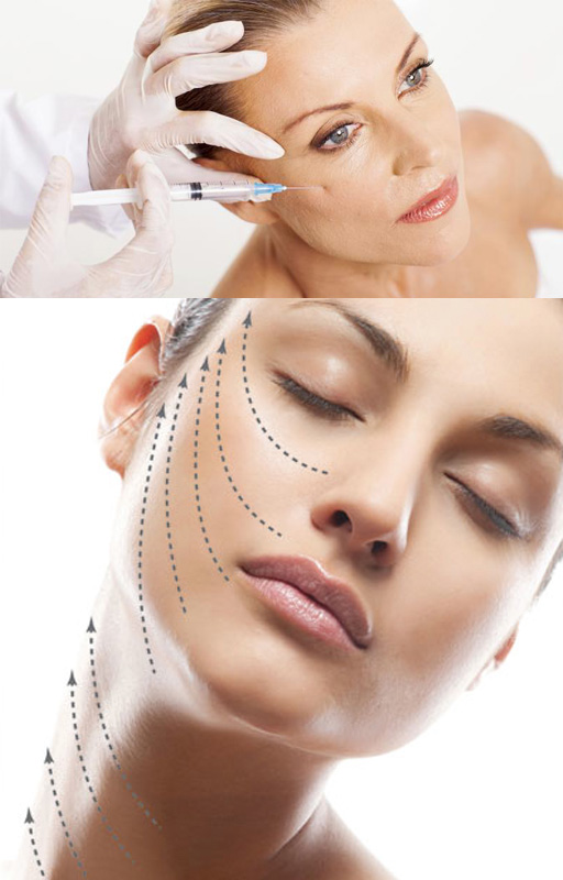  Perawatan Tanam Benang dari Aisyiah Beauty Clinic