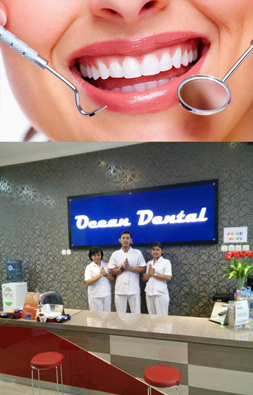  Paket Perawatan Gigi dari Ocean Dental Kramat Jaya 02