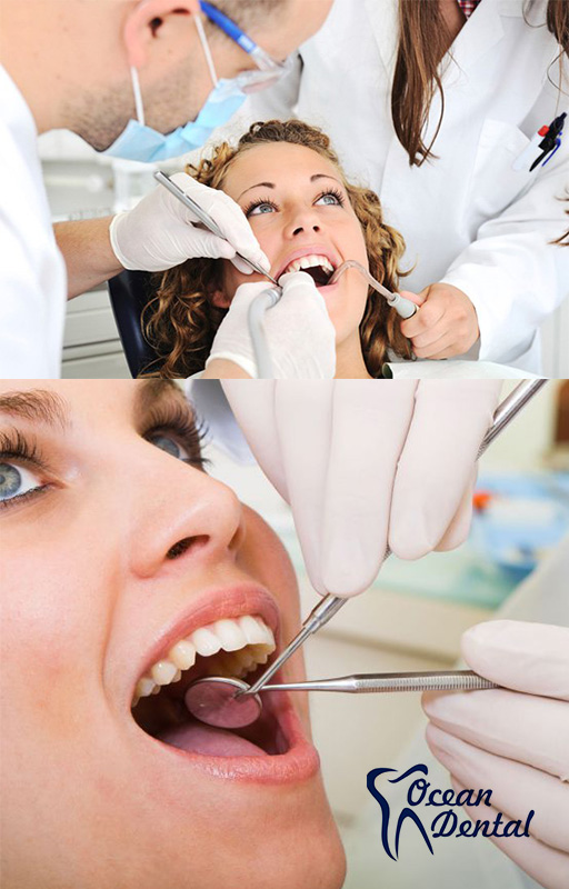  Paket Perawatan Gigi dari Ocean Dental Kramat Jaya 02