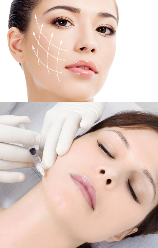  Perawatan Tanam Benang dari Aisyiah Beauty Clinic