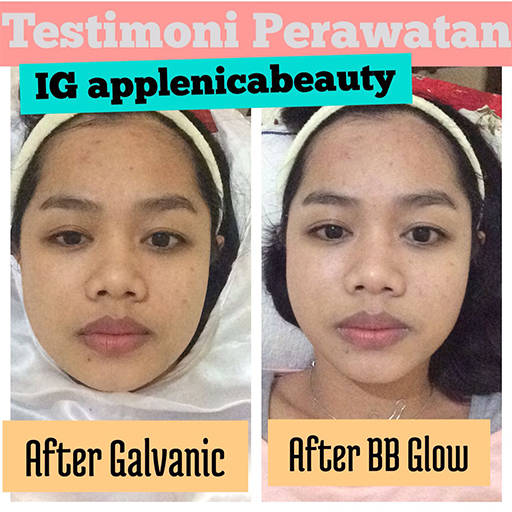 3x BB Glow Treatment