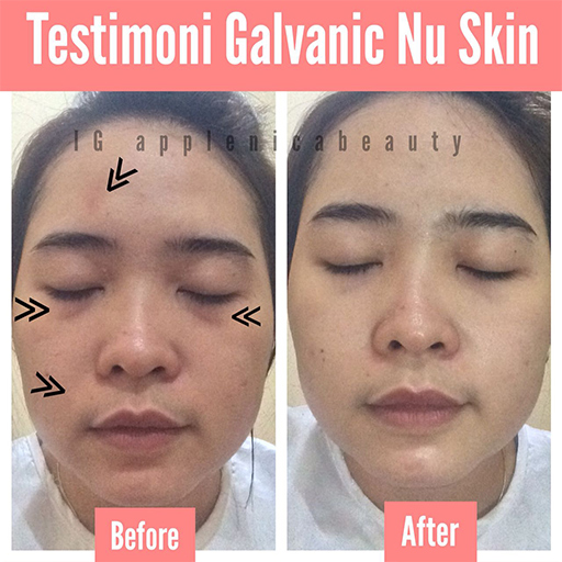 3x BB Glow Treatment