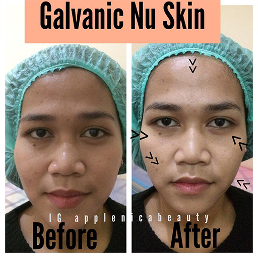 3x BB Glow Treatment