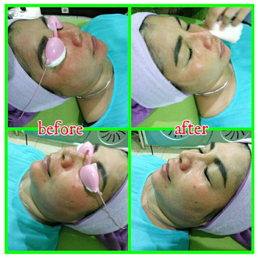  Voucher Value 25.000 bernilai 100.000 dari Zahira Skincare