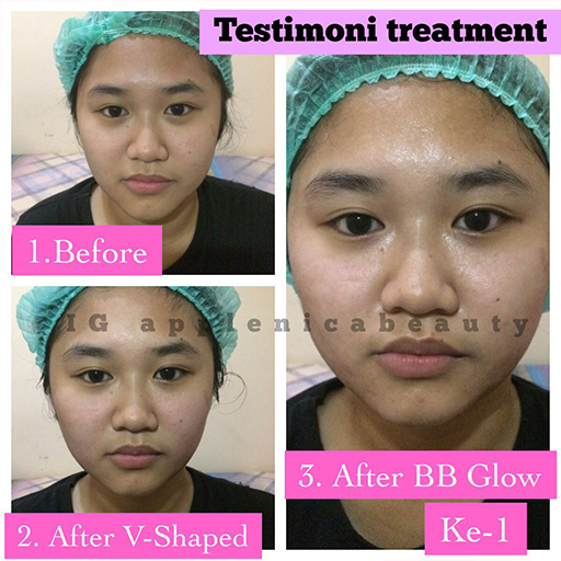 3x BB Glow Treatment