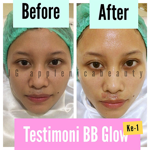 3x BB Glow Treatment