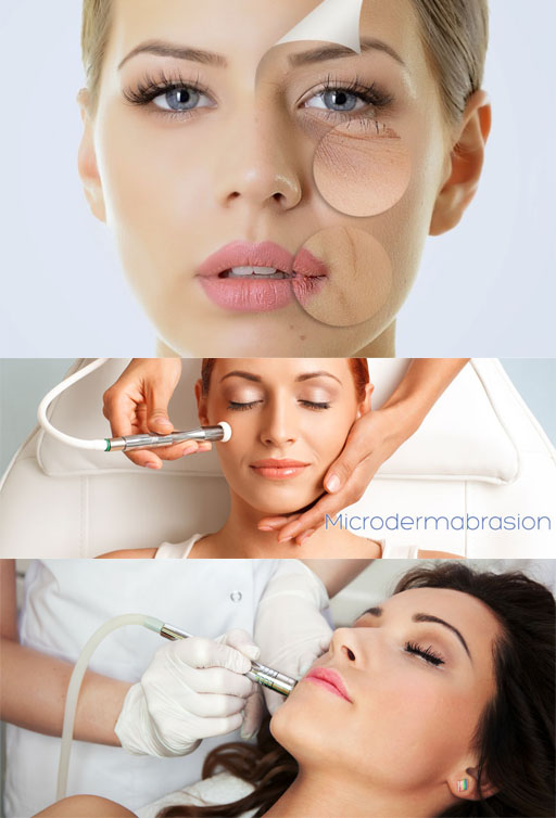  4 Skin Treatment Package 02